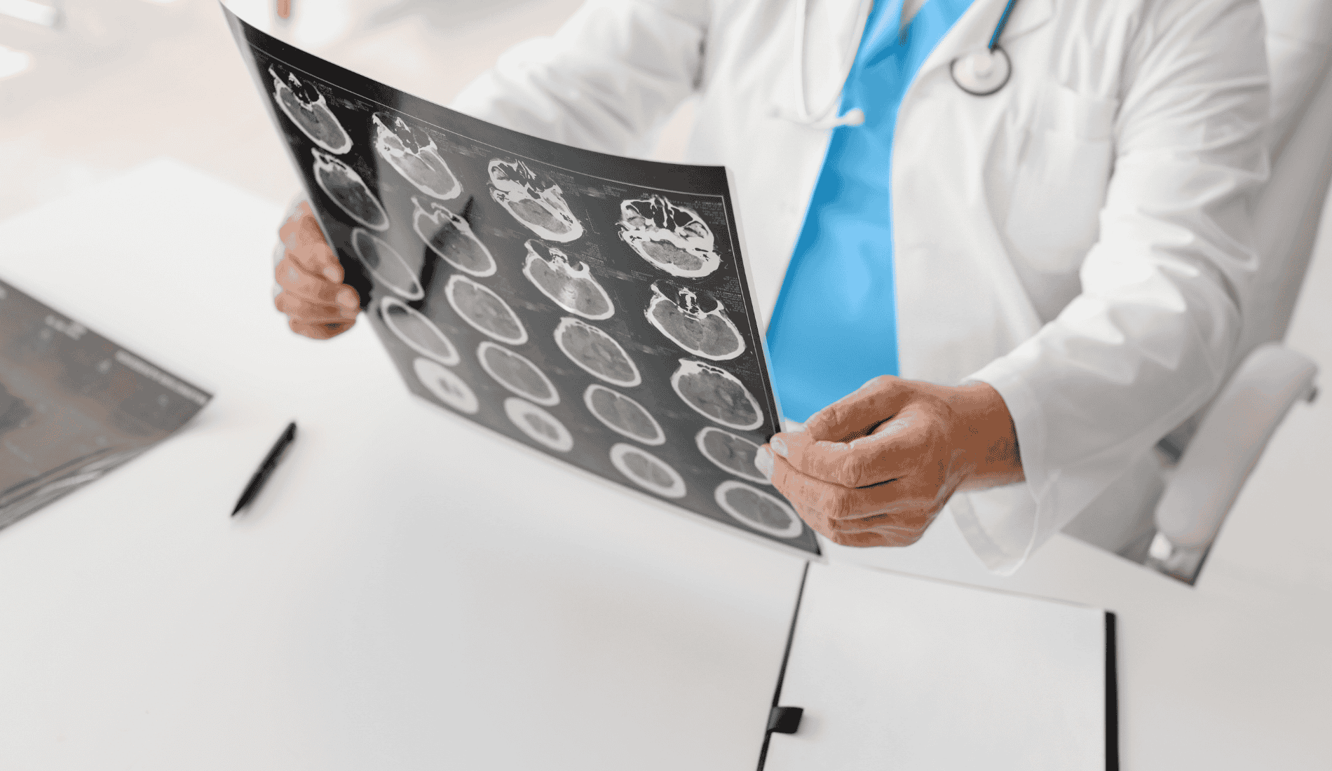 NEUROLOGIA A PRATO